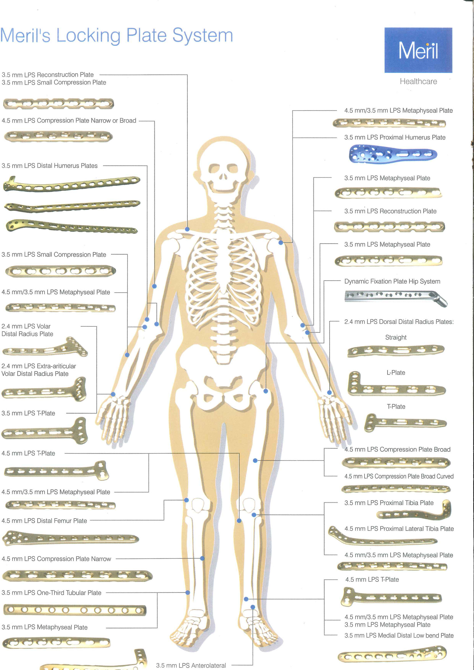 ARMAR 2.4mm Locking Plate System Instrument Set