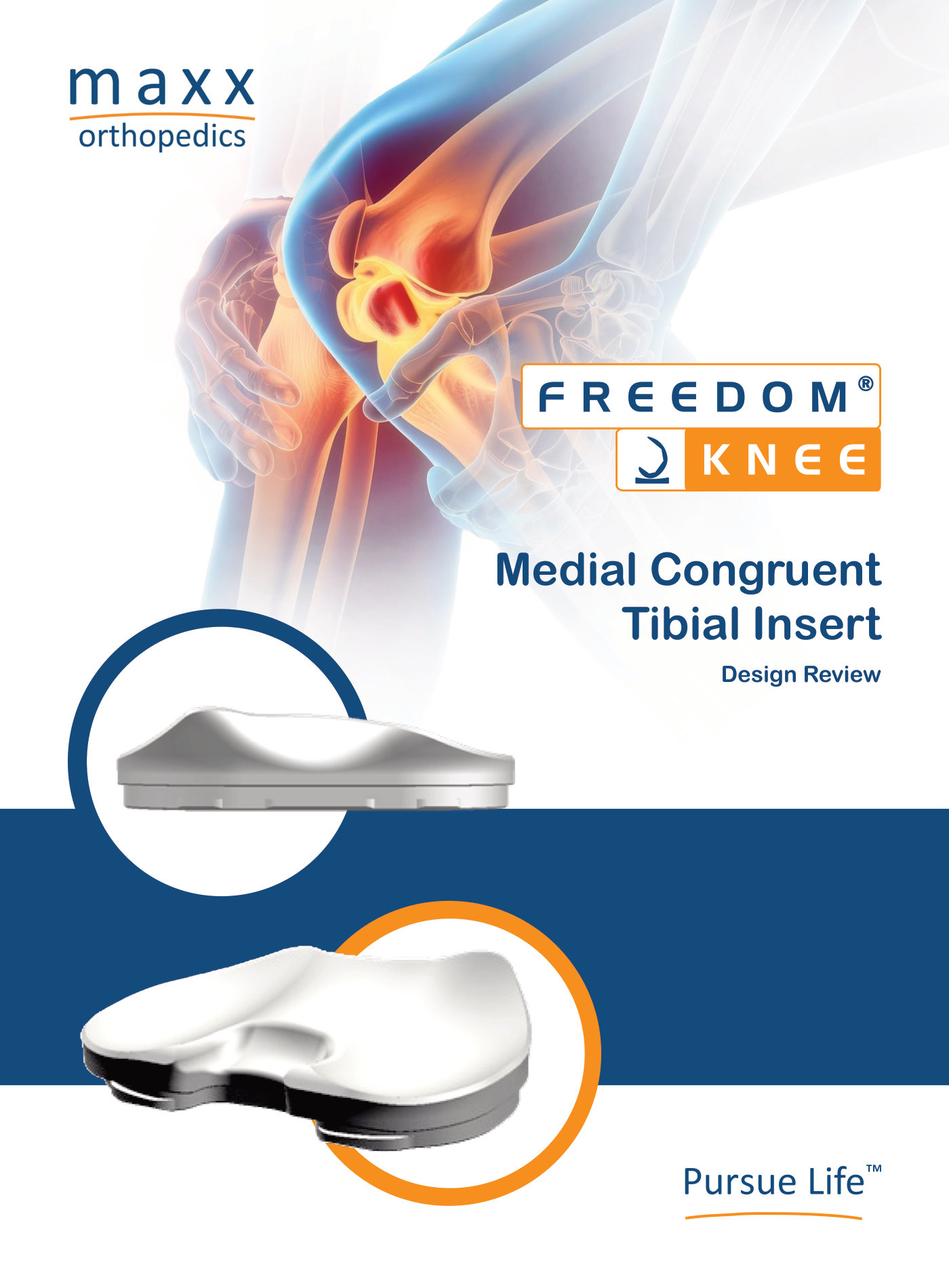 Freedom Knee Medial Congruent Tibial Insert
