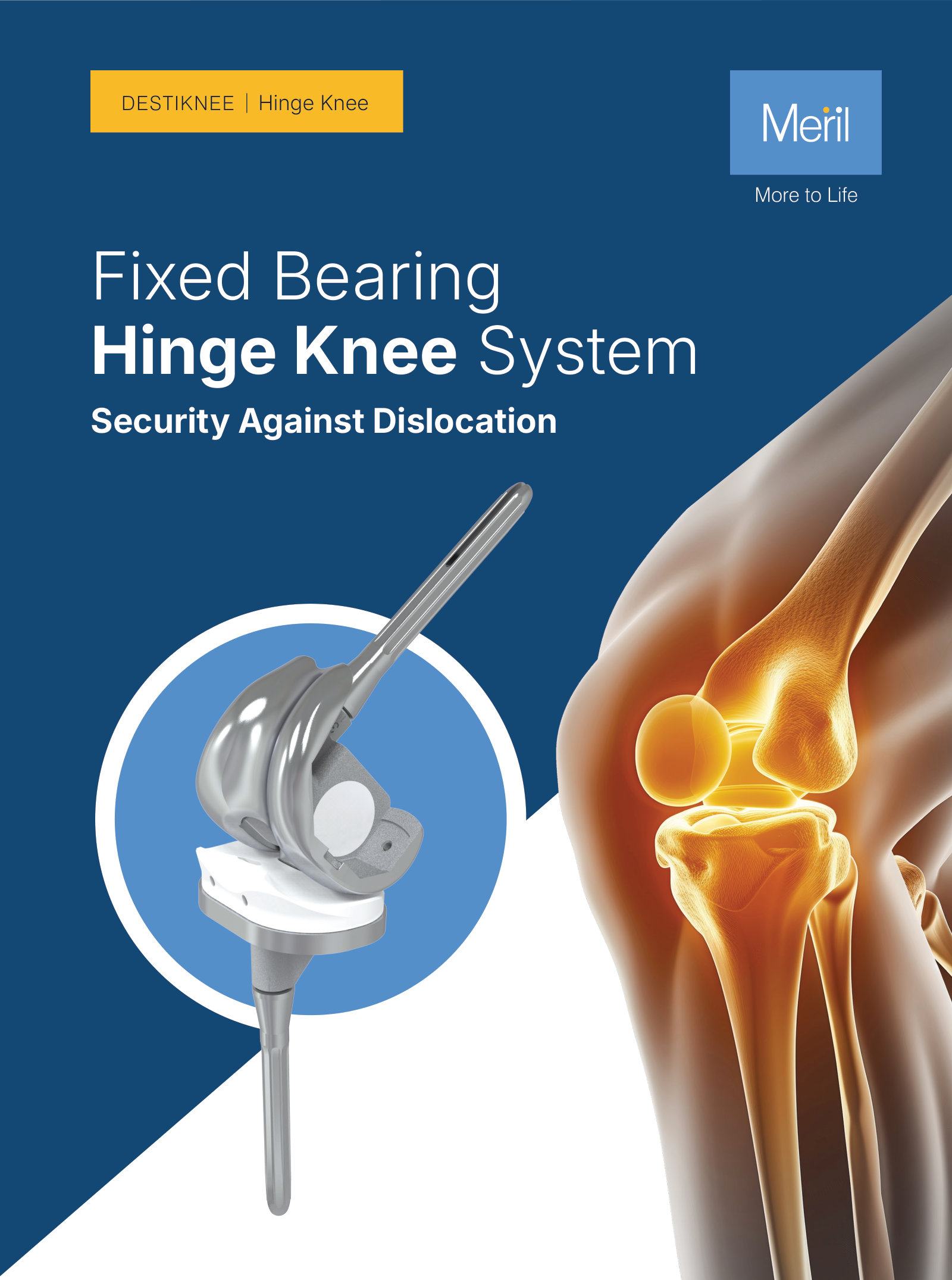 DESTIKNEE Hinge Knee System