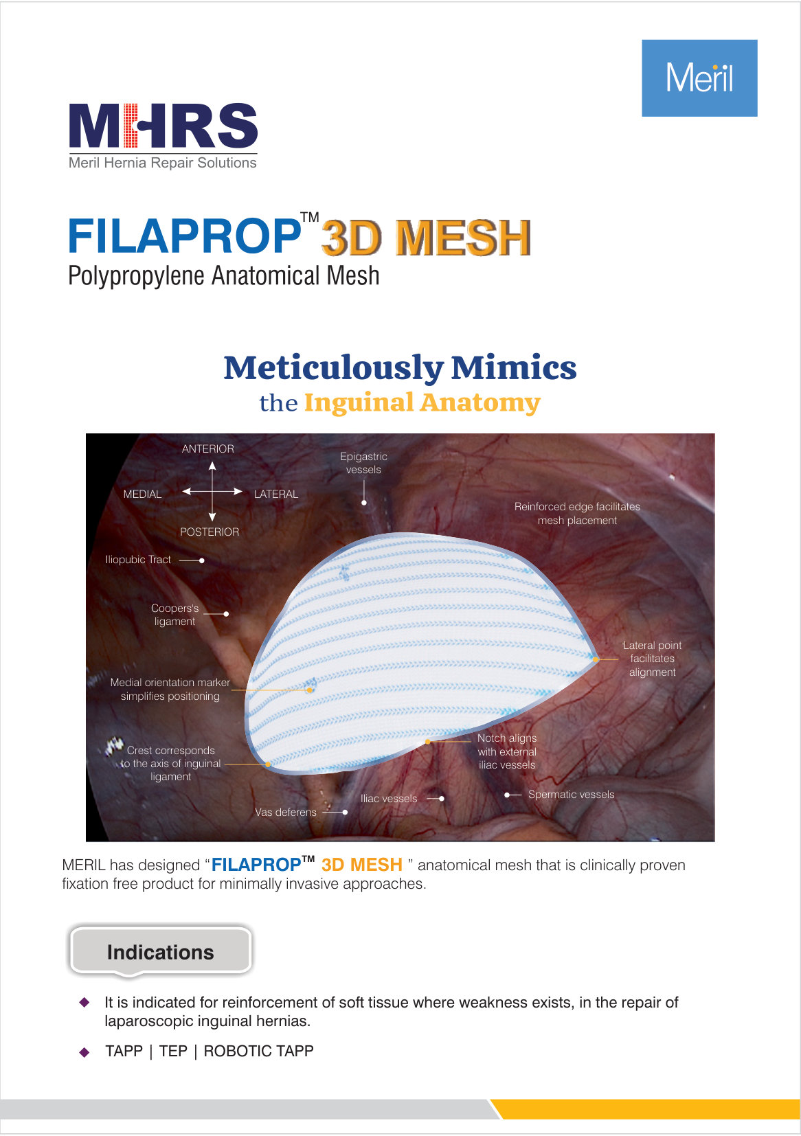 FILAPROP 3D MESH Medium Left